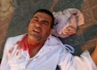 Novi teroristički akti cionističkih doseljenika: Pokušali ubiti Palestinca u gradu Lod