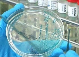 SZO: Od malarije u 2018. godini preminulo 405.000 osoba medicina uzorak