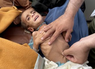 UN: Afganistanu hitno treba pomoć za spašavanje od gladi Glad u Afganistanu