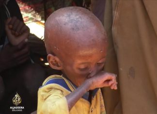 U Somaliji stotine hiljada teško neuhranjene djece