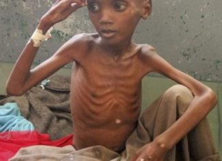UN upozorava na glad u Somaliji Glad u Somaliji
