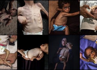 Djeca koja umiru od gladi u Gazi najbolnije lice humanitarne tragedije